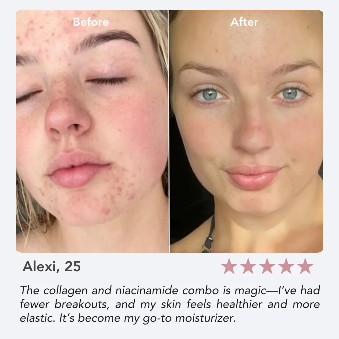 Anti-Aging Collagen Jelly Cream - Image 7