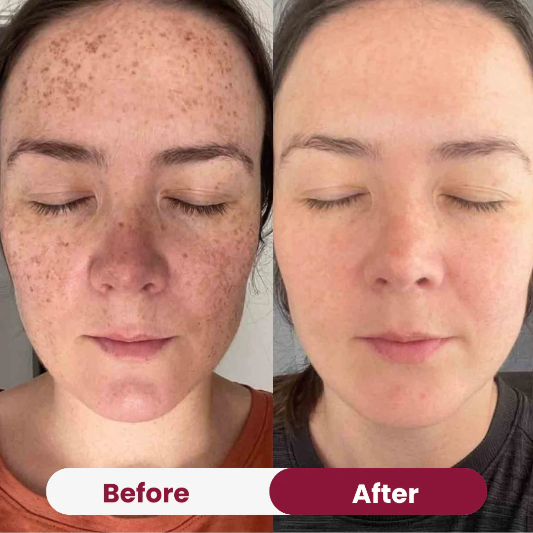Anti-aging Niacimide 10+ Serum - Image 8