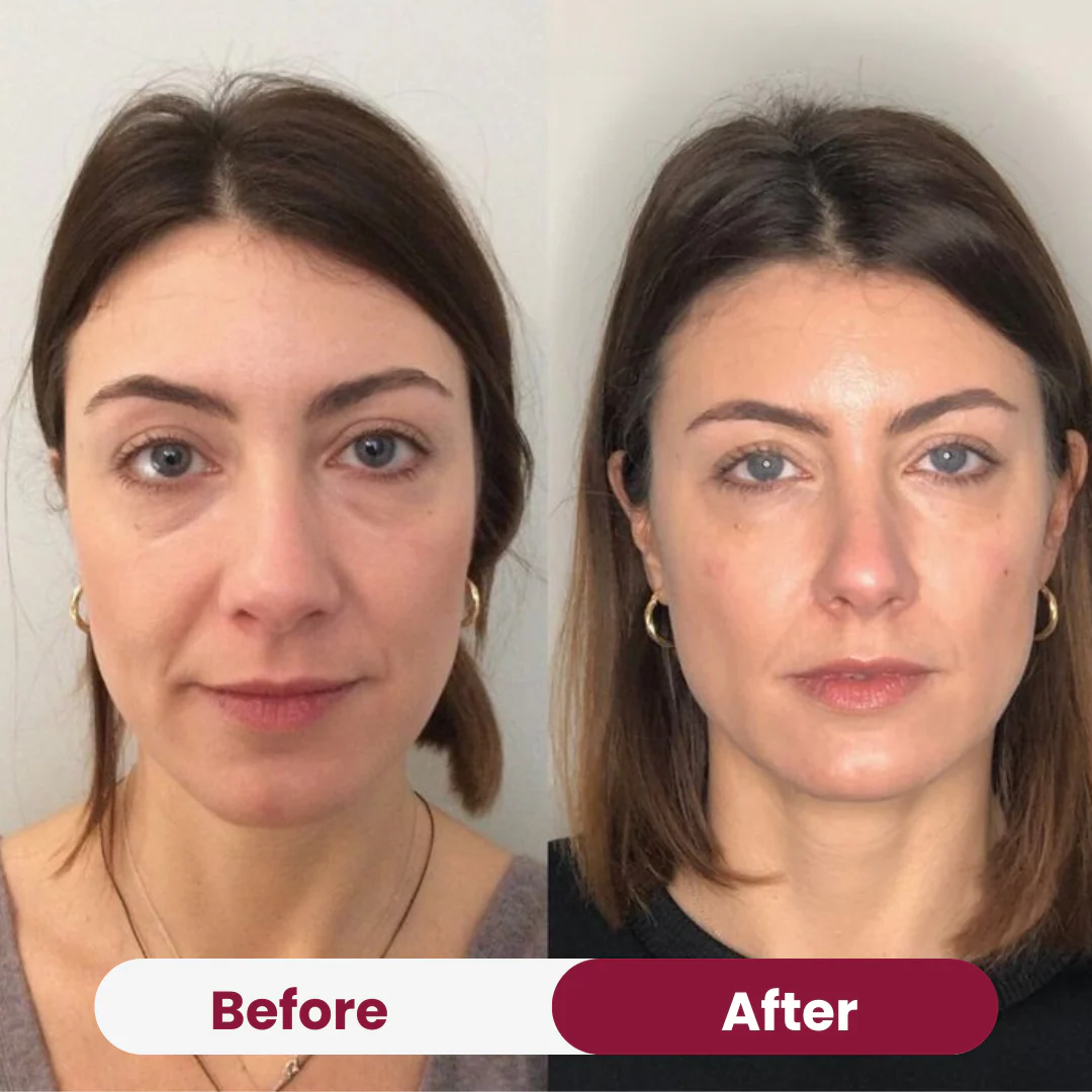 Anti-Wrinkle Collagen Mask - Image 8