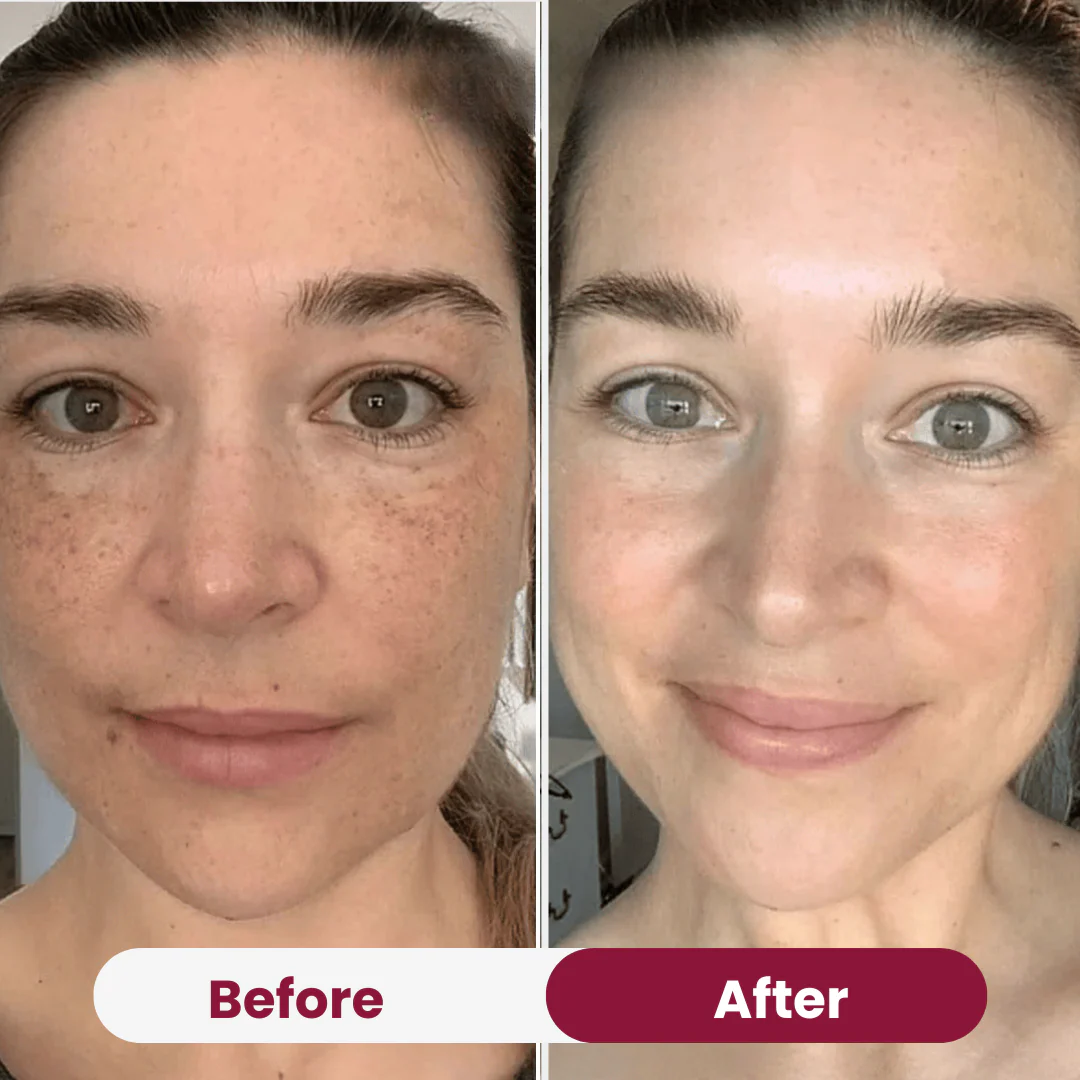 Bio-Collagen Mask - Image 9