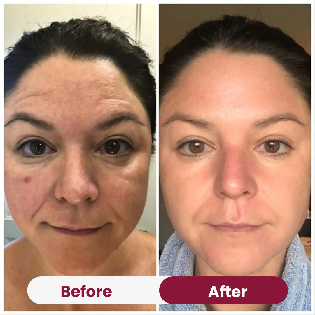 Collagen Wrapping Mask - Image 9