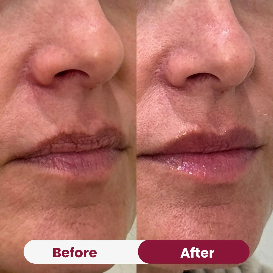 Collagen Mask & Mouth Tape Duo - Image 4