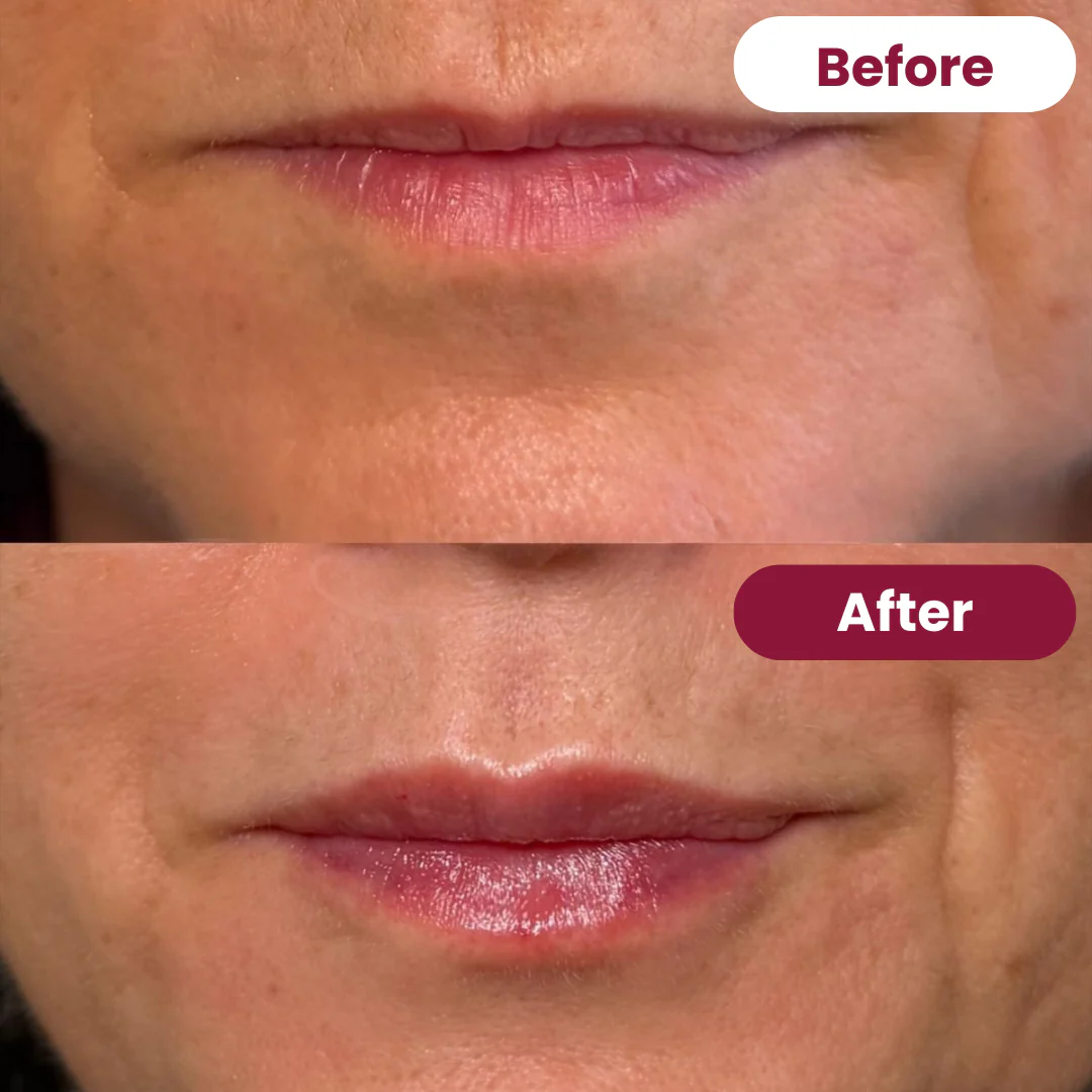 Collagen Mask & Mouth Tape Duo - Image 6
